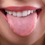 How does dry mouth affect long-term dental care and Daily Comfort?