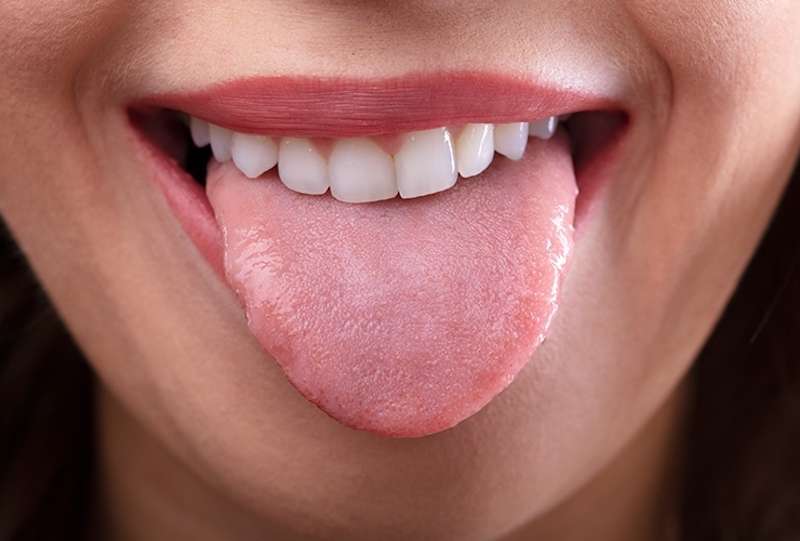 How does dry mouth affect long-term dental care and Daily Comfort?
