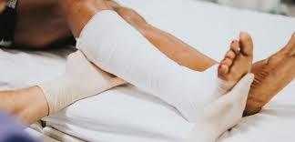 How to Document Recovery After a Serious Accident